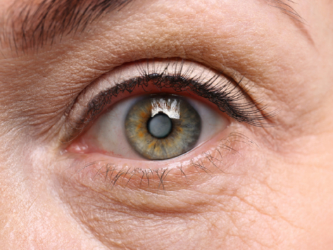 عملية المياه البيضاء في الإمارات