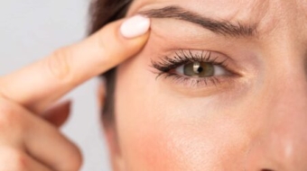 Eye Cosmetic Surgery