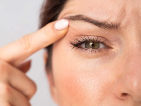 Eye Cosmetic Surgery