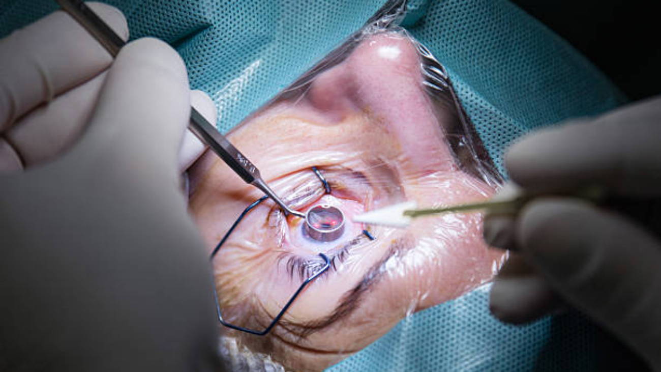 The Best Cornea Doctor in Dubai